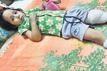 पार्क में लगी फिसलपट्टी में छेद, फंसकर कट गई बच्ची की अंगुली