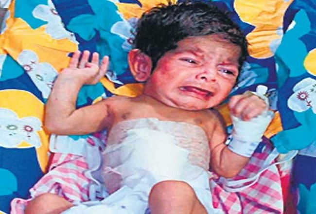 नवजात का ऑपरेशन कर बनाई आहार नाल, दावा-राज्य में पहली बार हुई ऐसी सर्जरी