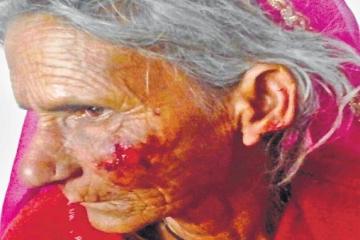 बुजुर्ग महिला के कान काट टॉप्स ले गए लुटेरे, किसी ने नहीं सुनी चीखें