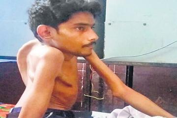 युवक को बच्चे की तरह एनेस्थीसिया देकर किया ऑपरेशन