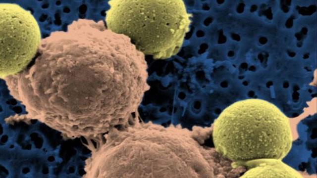 Govt changes norms for cancer docs training